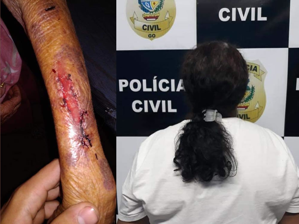 Imagem de Polícia Civil prende mulher após agredir a própria mãe
