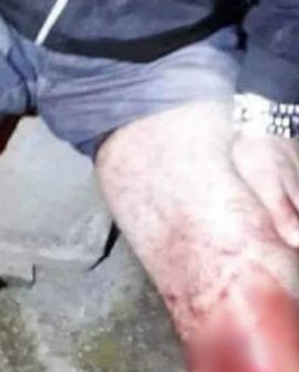Imagem de Comerciante é baleado na perna durante roubo