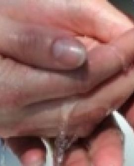 Imagem de Transtorno Obsessivo Compulsivo - Minhas manias podem ser uma doença?