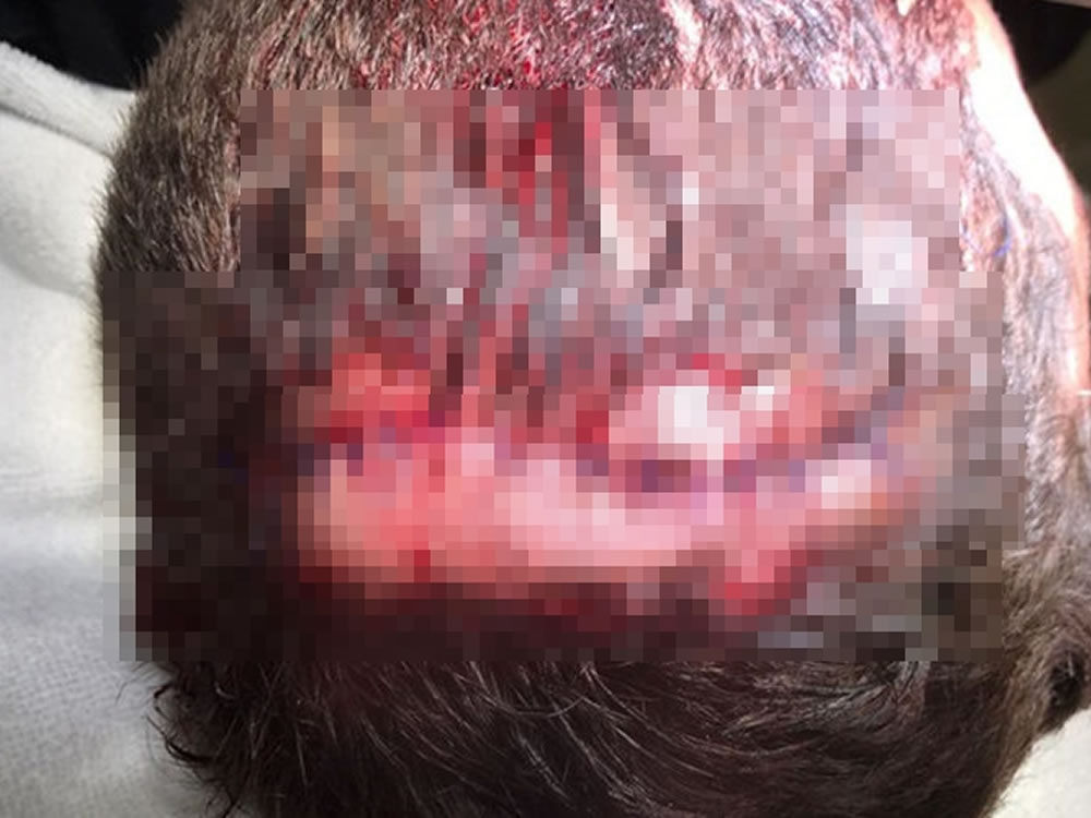 Imagem de Homem faz amizade no prostíbulo e termina assaltado, em Rio Verde