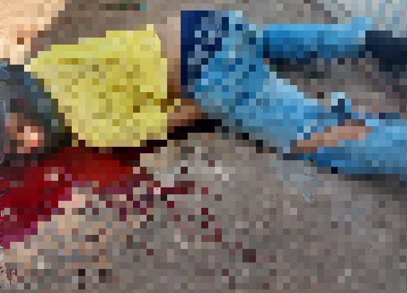 Imagem de Homem em acidente no Residencial Canaã