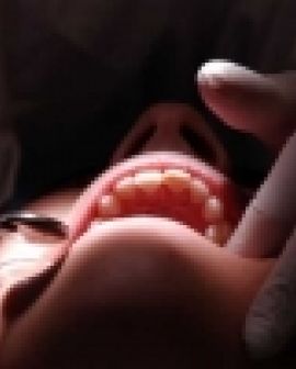Imagem de Fesurv anunciou curso de Odontologia