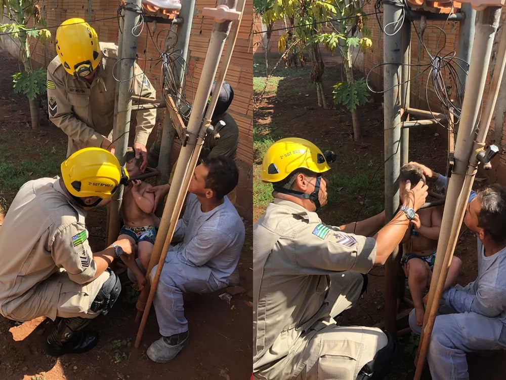 Imagem de Menino de 2 anos é resgatado após ficar preso pela cabeça em torre metálica