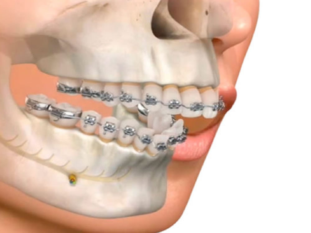 Imagem de HURSO é único Hospital com atendimento de bucomaxilofacial no sudoeste goiano
