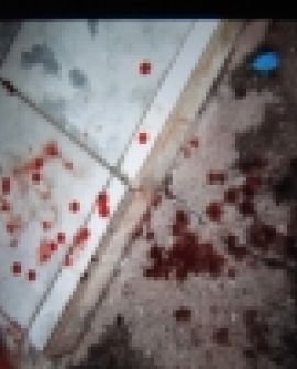Imagem de Homem assassinado no Parque dos Buritis