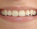 Imagem de Centro de Especialidades Odontológicas será lançado hoje